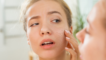 Die 10 besten Tipps gegen trockene Haut