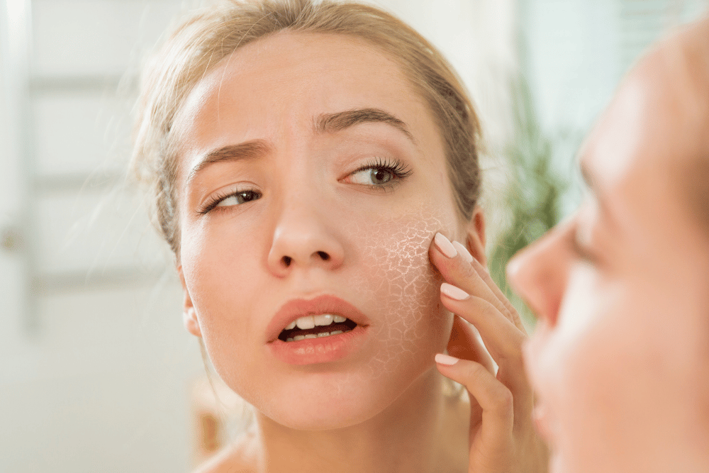 Die 10 besten Tipps gegen trockene Haut
